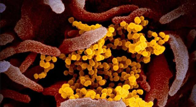 1589448841654457.jpg 1589448841654457.jpg